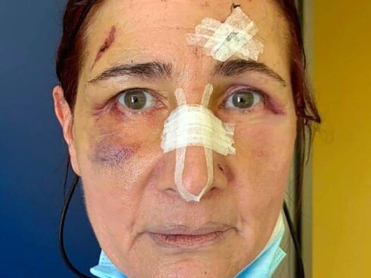 "Ho pensato di morire", Stefania aggredita per aver chiesto di indossare la mascherina - 