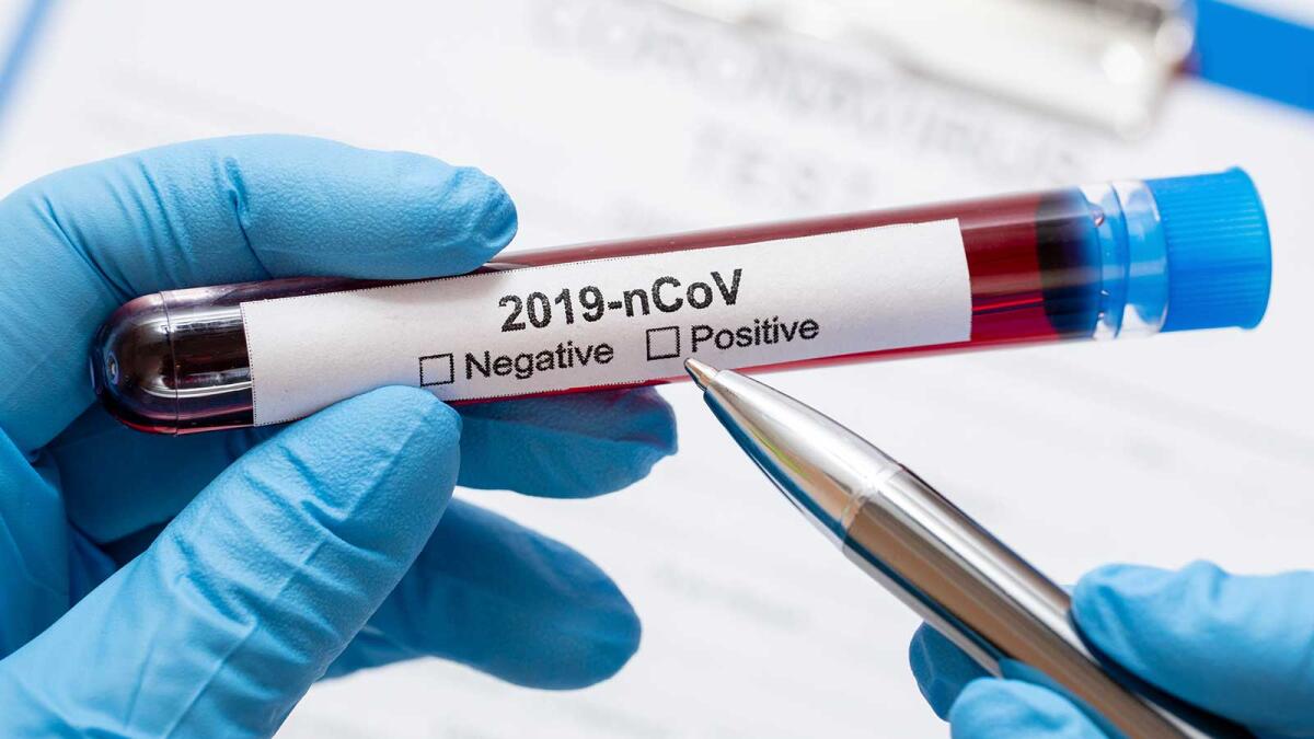Coronavirus, 61 nuovi casi positivi in Puglia: registrati oggi 1820 test - 