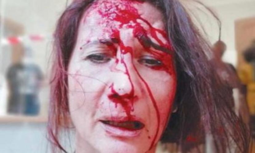 "Ho pensato di morire", Stefania aggredita per aver chiesto di indossare la mascherina