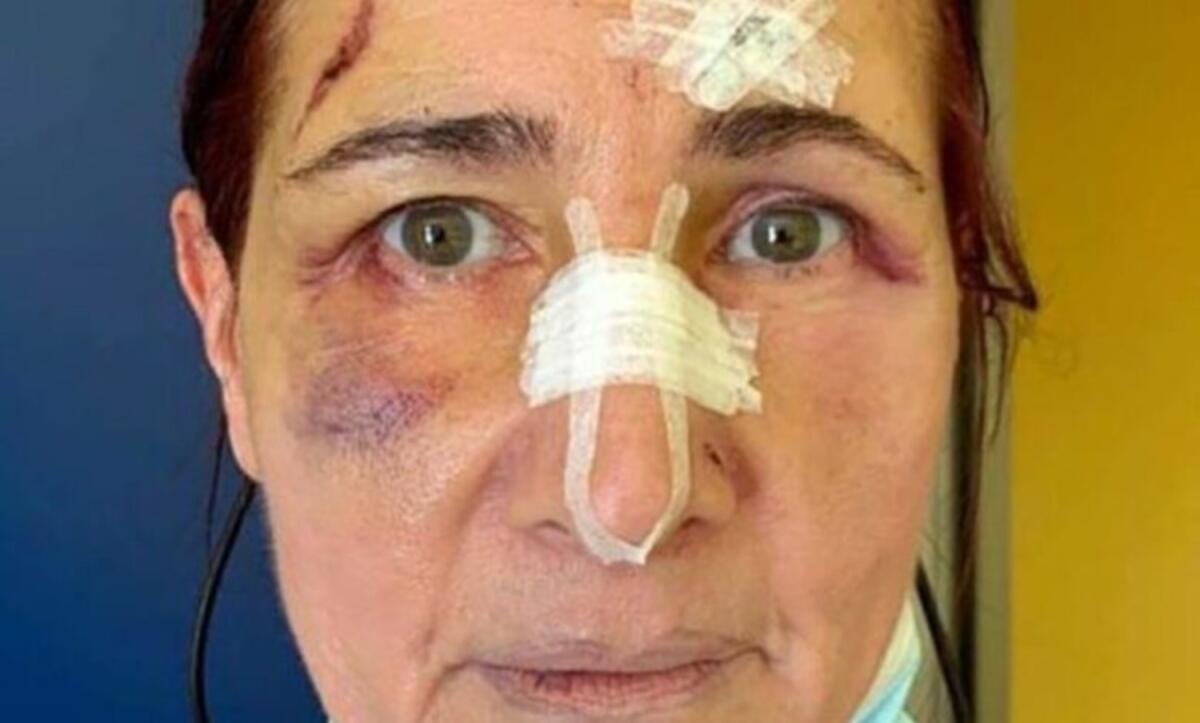 Foggia, condannato maliano che ruppe il naso all'operatrice sanitaria per una mascherina - 