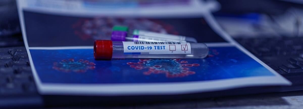 Covid, contagi in calo in Puglia. Emiliano: "Il numero delle infezioni sta finalmente diminuendo" - 