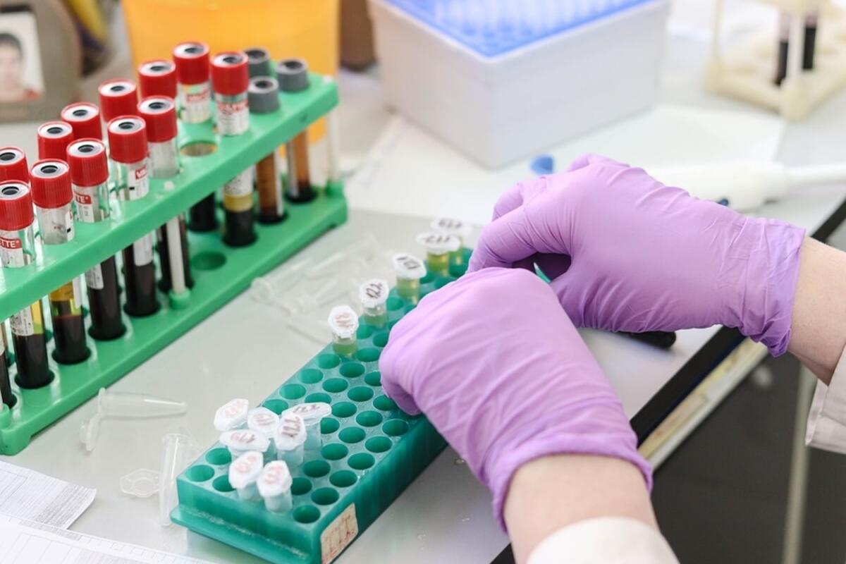 Terapia con anticorpi monoclonali a pazienti Covid: operativi gli ospedali di San Severo e Cerignola - 