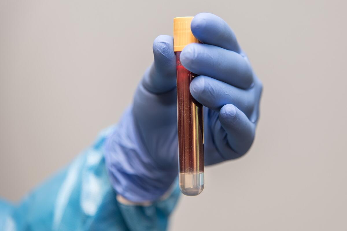 Foggia, il Policlinico Riuniti invita a donare il sangue: la terapia trasfusionale è salvavita per molti pazienti - 