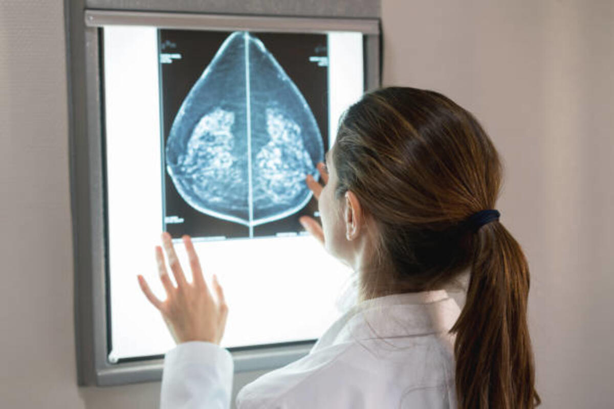 Al Policlinico Riuniti di Foggia la giornata nazionale di sensibilizzazione sul tumore al seno metastatico - 