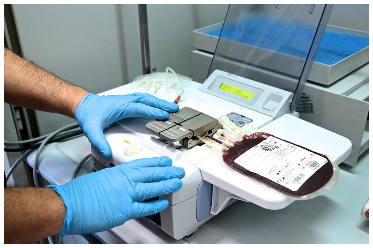 Casa Sollievo invia sangue da cordone ombelicale negli USA - 
