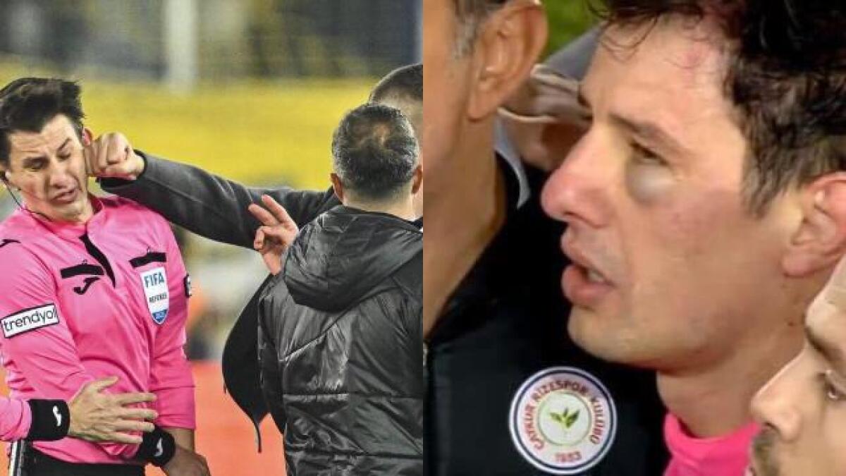 Pesta arbitro in Turchia, presidente arrestato - 