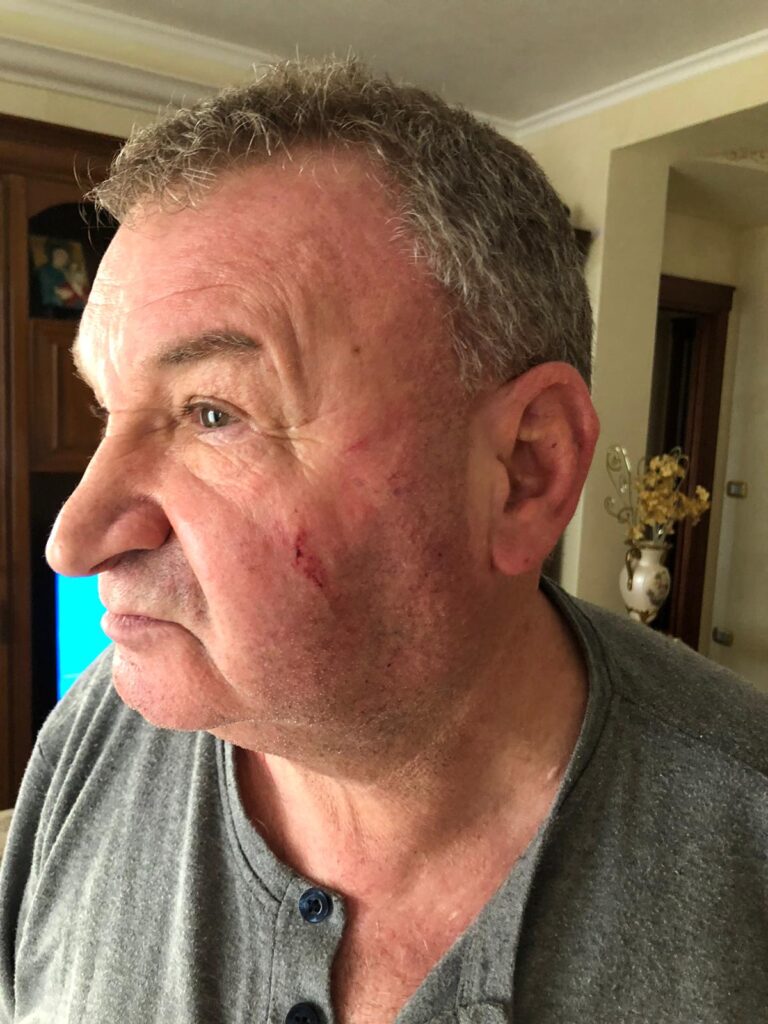 Manfredonia: sindacalista aggredito anche con una mazza